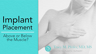Implant Placement Debate: Over vs. Under the Muscle